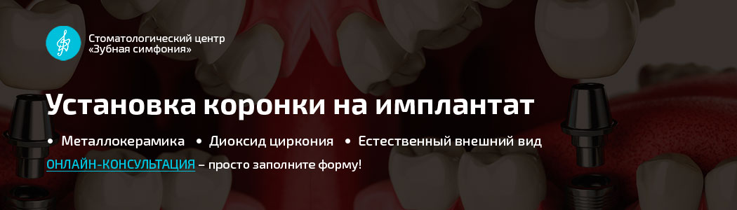 Металлокерамическая коронка на зуб, цены
