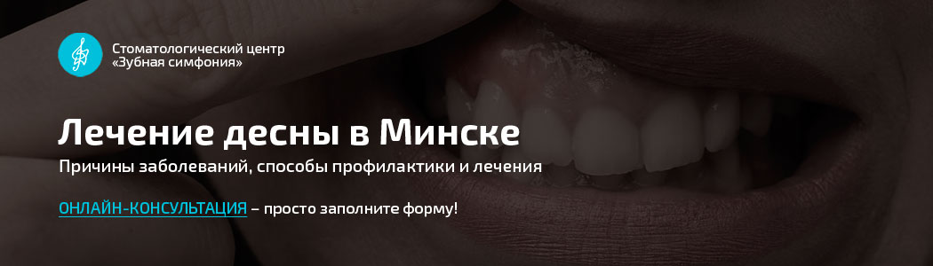 Лечение дёсен в Минске, Белоруссии, цены