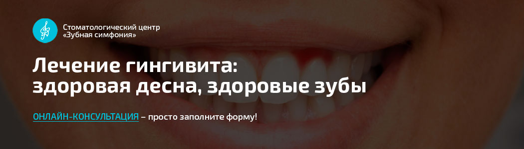 Лечение гингивита в Минске, цены, отзывы пациентов, примеры работ