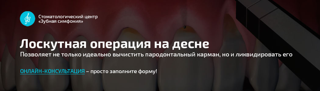 Лоскутная операция в Минске, Белоруссии, цены
