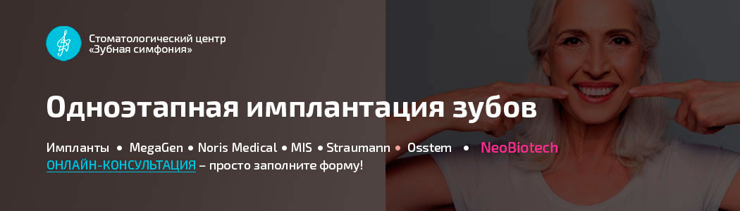 Одноэтапная имплантация зубов в Минске, Белоруссии, цены