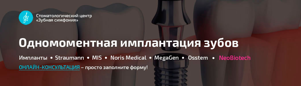 Одномоментная имплантация зубов в Минске, Белоруссии, цены