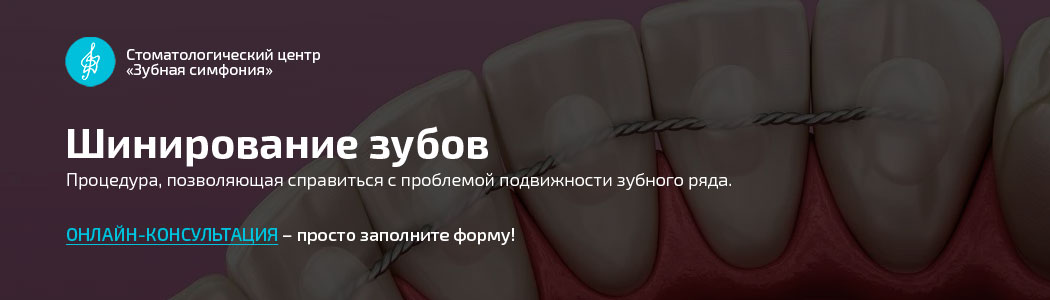 Шинирование зубов в Минске, Белоруссии, цены