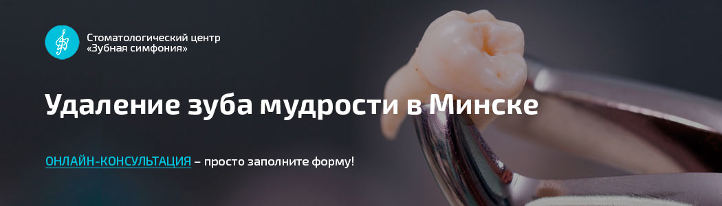 Удаление зуба в Минске, цены