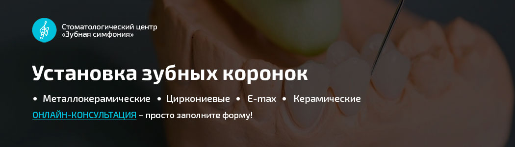 Установка зубных коронок, Белоруссии, цены