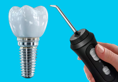 Ирригатор для имплантов и коронок: зачем нужен, как выбрать и правильно использовать