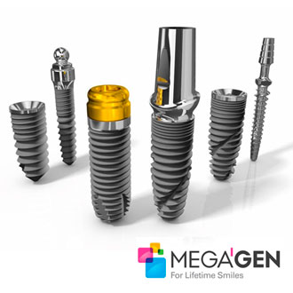 Импланты MegaGen цена на установку в Минске (Белоруссия), отзывы
