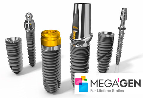 Импланты MegaGen цена на установку в Минске (Белоруссия)