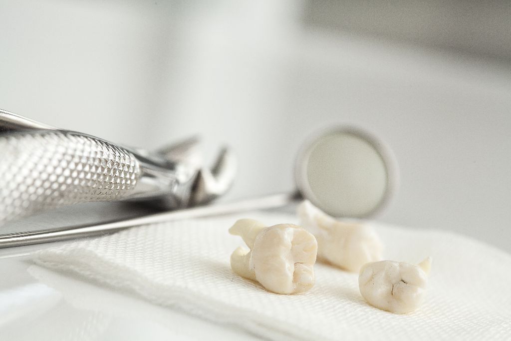 ЗУдаление зубов в Минске, Белоруссия цены на удаление зуба