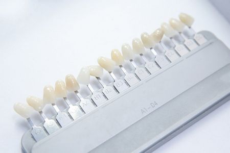 Установка виниров на зубы в Минске, Белоруссия цены
